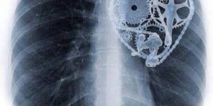 自転車乗りの心臓！？ギア・ハート